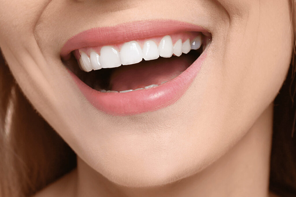 Hollywood Smile en Turquía